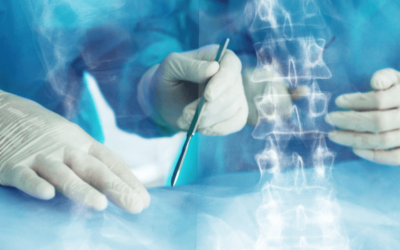 2018 CPT Code Changes for Orthopedic Spinal Surgery