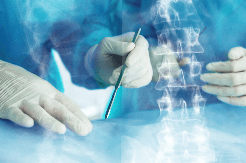 2018 CPT Code Changes for Orthopedic Spinal Surgery