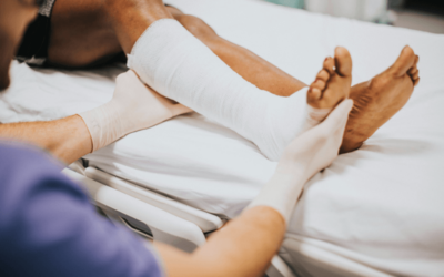 Orthopedic Medical Coding Ideas for Closed Treatment of Fractures without Manipulation