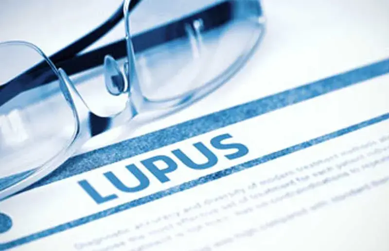 How to Report Systemic Lupus Erythematosus With ICD 10 Codes