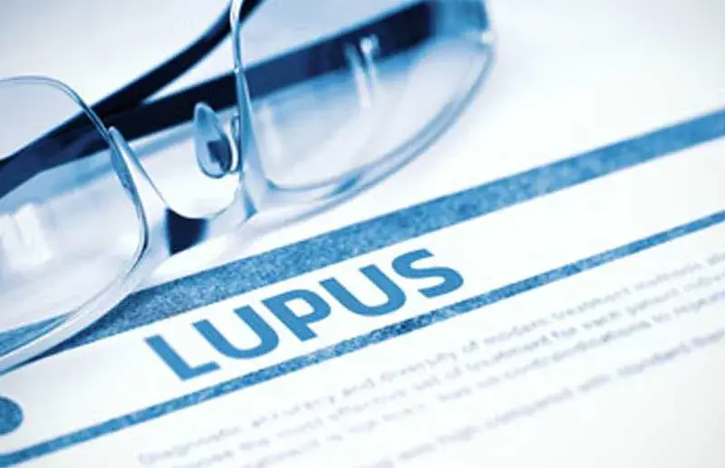 How To Report Systemic Lupus Erythematosus with the Correct ICD-10 Codes