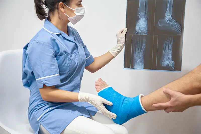 Orthopedic Medical Coding Ideas for Closed Treatment of Fractures without Manipulation