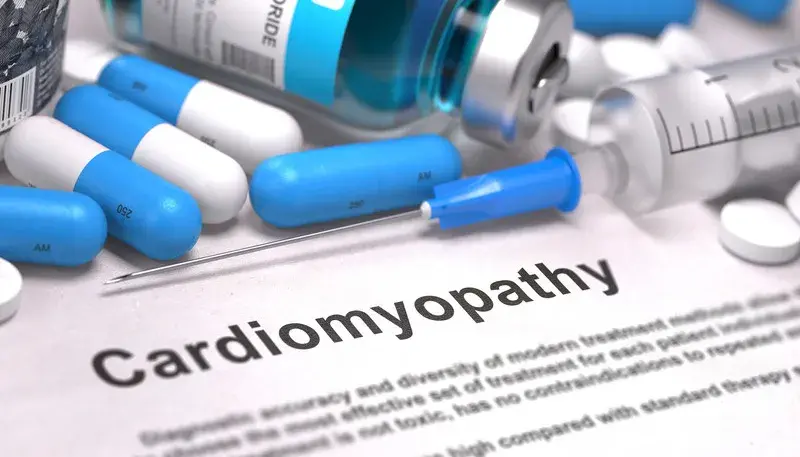How to Document Cardiomyopathy with Accurate ICD-10 Codes