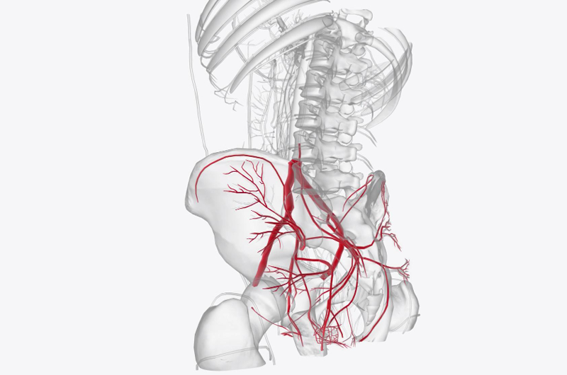 2018 CPT Coding Changes for Endovascular Repair of Abdominal Aorta and/or Iliac Arteries