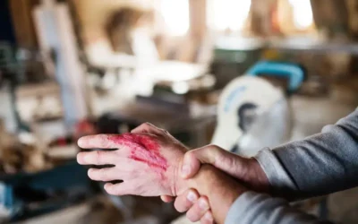 How to Code for Open Wounds Using ICD-10 and CPT Medical Codes