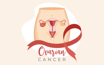 How to Document Ovarian Cancer Using ICD-10 and CPT Medical Codes