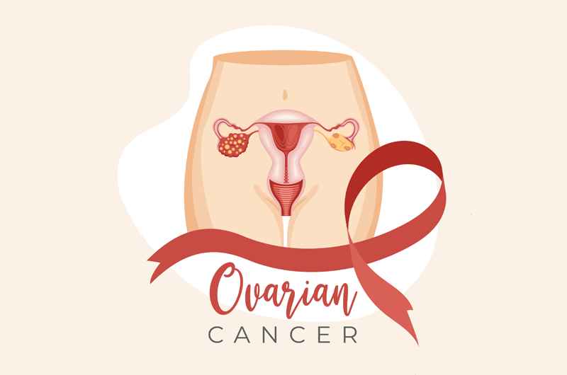 How to Document Ovarian Cancer Using ICD-10 and CPT Medical Codes