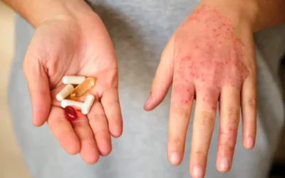 Drug Allergy Documentation and Medical Coding