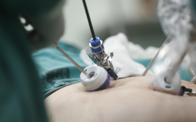 Gastrostomy Tube Placement – 2018 ICD-10 and CPT Codes