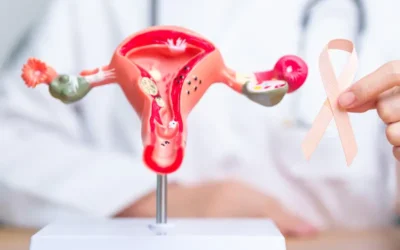 How to Document Ovarian Cancer Using ICD-10 and CPT Medical Codes