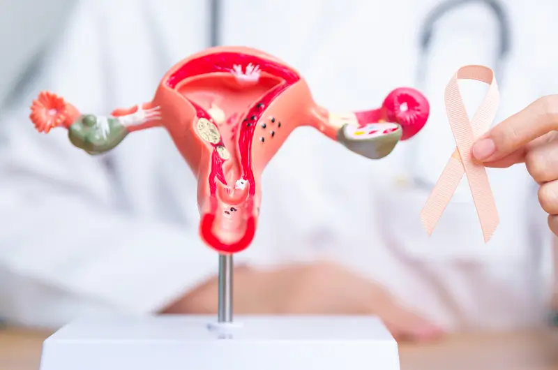 How to Document Ovarian Cancer Using ICD-10 and CPT Medical Codes