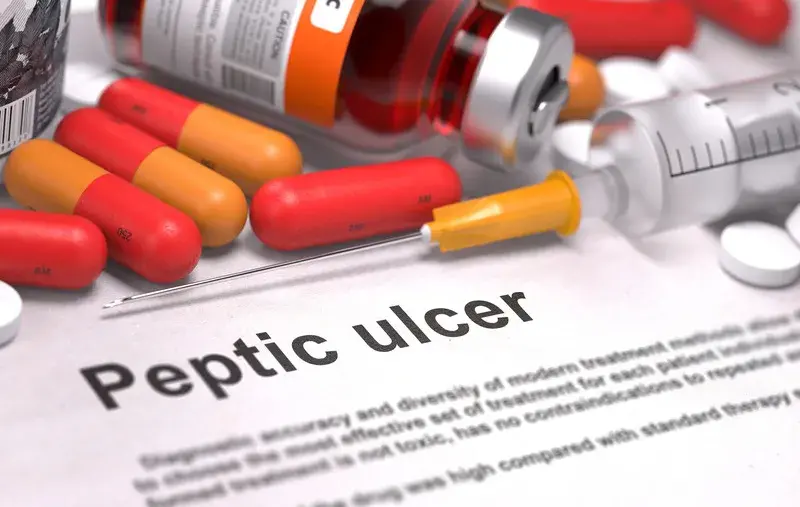 Peptic Ulcer Symptoms Diagnosis
