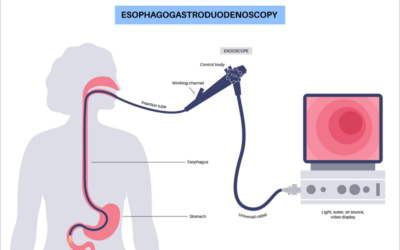 Reporting Diagnostic and Therapeutic Esophagogastroduodenoscopy in 2018