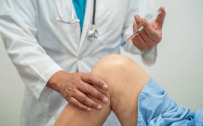 Arthrocentesis – Key Coding and Billing Points
