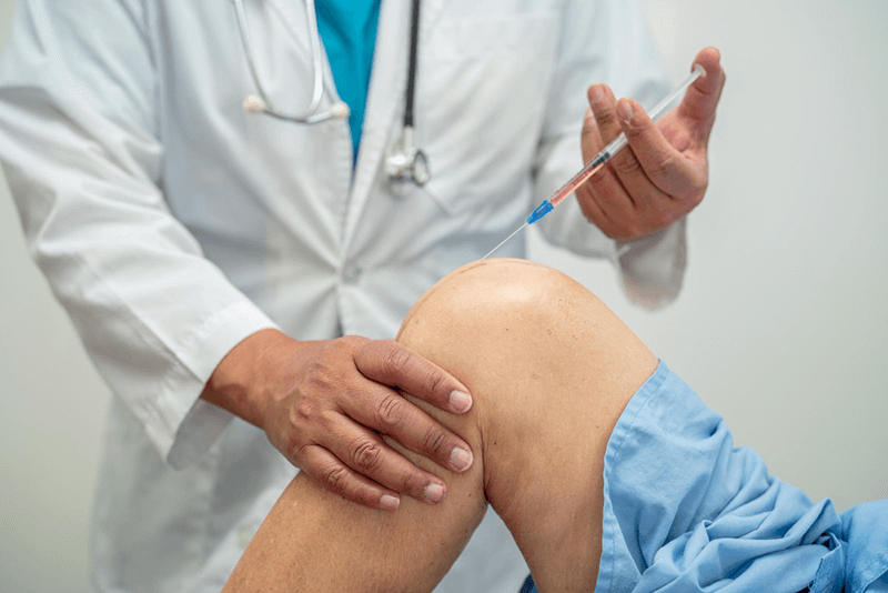 Arthrocentesis Coding and Billing Points
