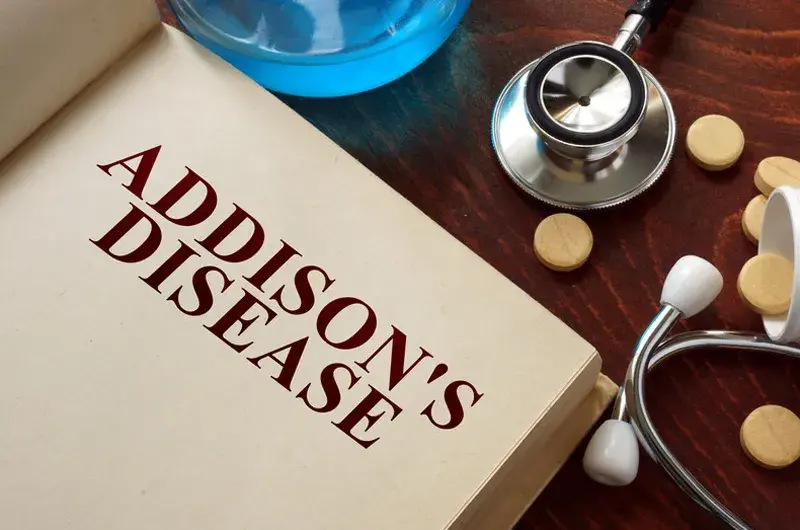 How to Code for Addison’s Disease Using ICD-10 Medical Codes