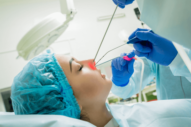 Reporting Functional Endoscopic Sinus Surgery (FESS) in 2018