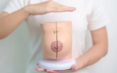 Coding for Mastectomy – Use the Correct ICD-10 and CPT Codes