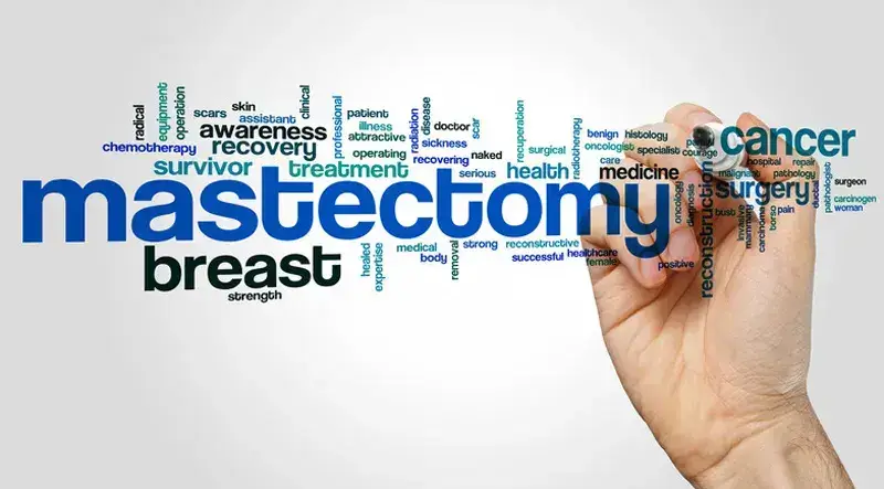 Coding for Mastectomy – Use the Correct ICD-10 and CPT Codes