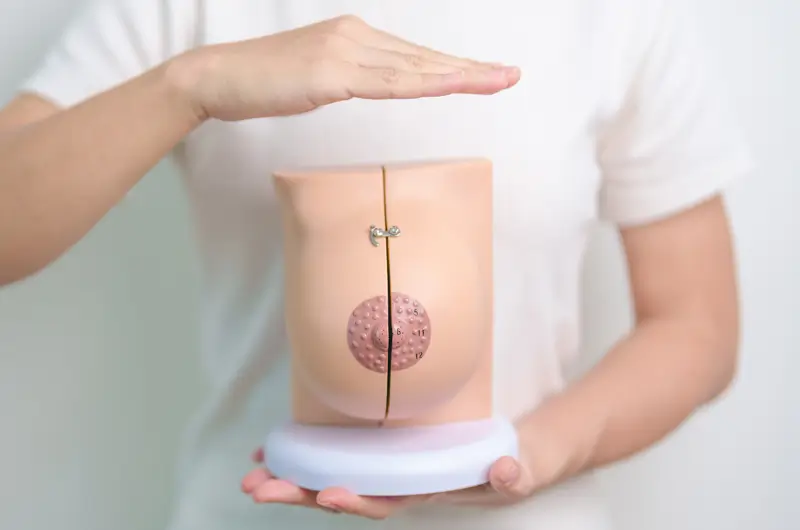 Coding for Mastectomy – Use the Correct ICD-10 and CPT Codes