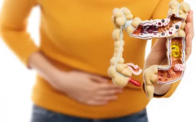 Documenting and Coding Crohn’s Disease – Key Considerations