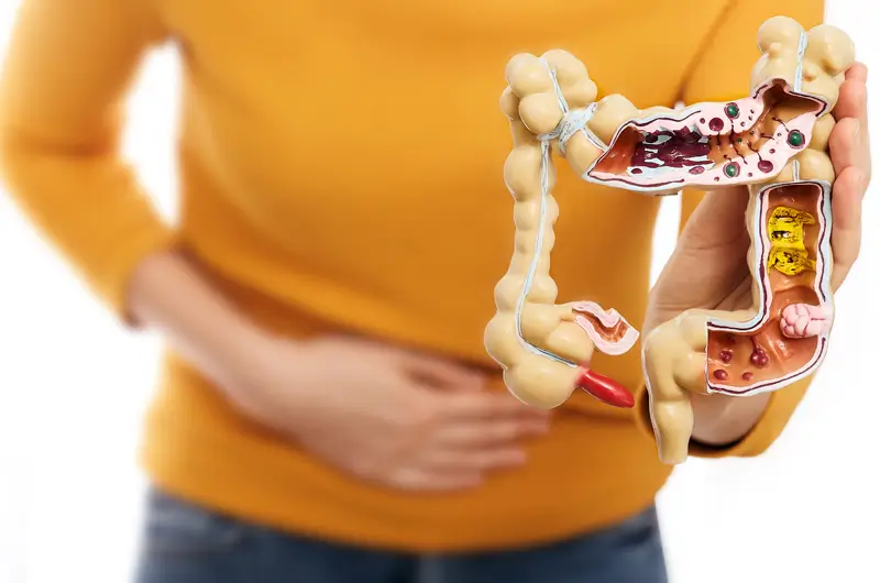 Documenting and Coding Crohn's Disease - Key Considerations