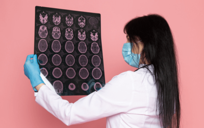 Documenting and Coding Subdural Hematoma – Know the ICD-10 Codes