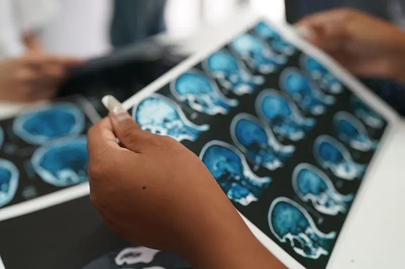 Documenting and Coding Subdural Hematoma – Know the ICD-10 Codes