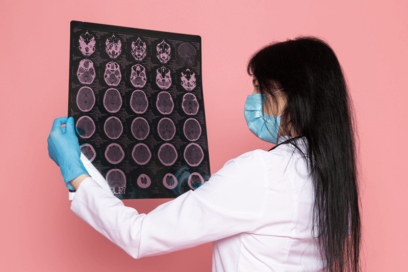 Documenting and Coding Subdural Hematoma