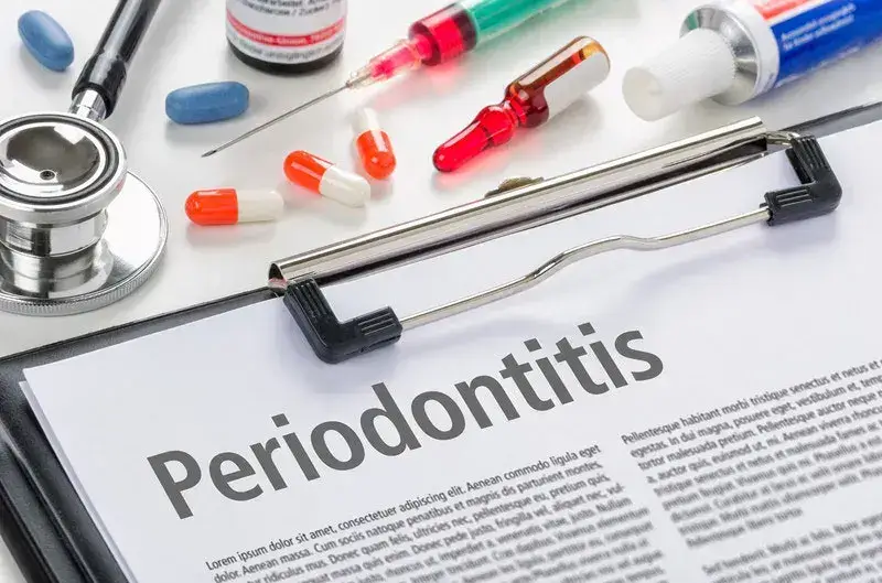 Documenting Coding Periodontitis