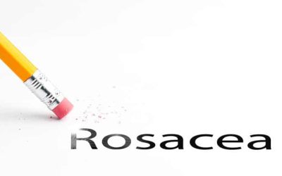Reporting Rosacea: An Overview of Diagnosis, Treatment and Coding