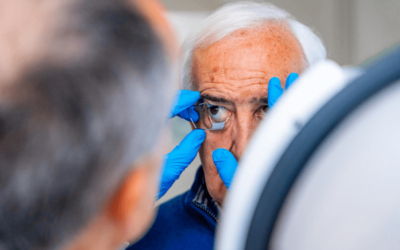 Reporting and Coding Central Serous Chorioretinopathy (CSR)
