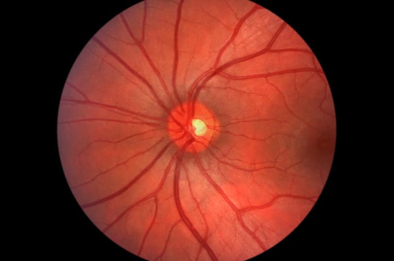 Observe Diabetic Eye Disease Awareness Month in November