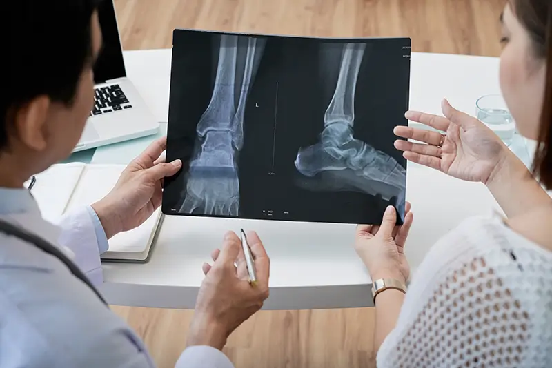 Osteomyelitis Coding in ICD-10 – Ensure Specificity
