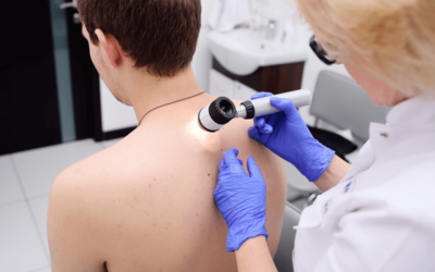Skin Biopsy 2019 Coding Updates