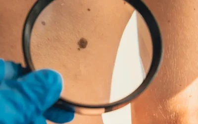 Skin Biopsy 2019 Coding Updates
