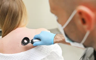 Melanoma – Symptoms, Diagnosis, Treatment and Medical Codes