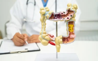 Coding Colectomy – Key Considerations for Claim Submission