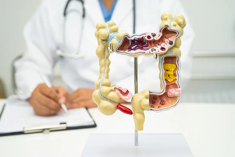 Coding Colectomy – Key Considerations for Claim Submission