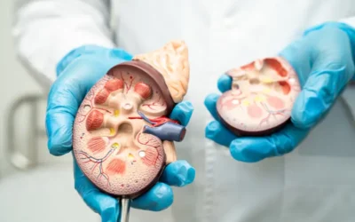 Use the Correct Medical Codes to Report Kidney Stones