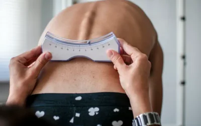 Reporting Scoliosis – An Overview of the Condition and Medical Codes