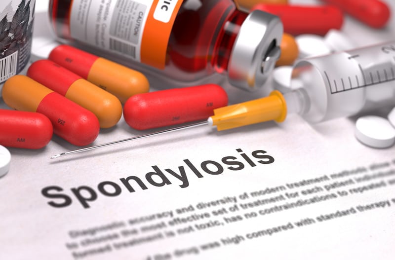 Codes for Documenting Spondylosis