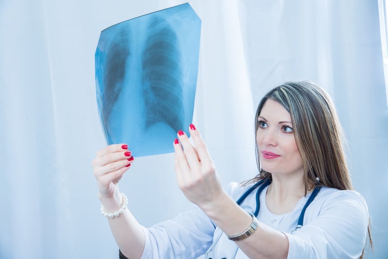 ICD 10 Codes to Report the Causes of Pneumonia This Flu Season