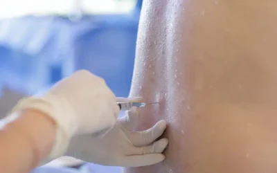 2019 CPT Codes for Epidural Injection Procedures and Diagnostic Selective Nerve Root Blocks