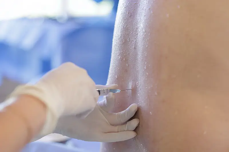 2019 CPT Codes for Epidural Injection Procedures 2019 CPT Codes for Epidural Injection Procedures and Diagnostic Selective Nerve Root Blocks