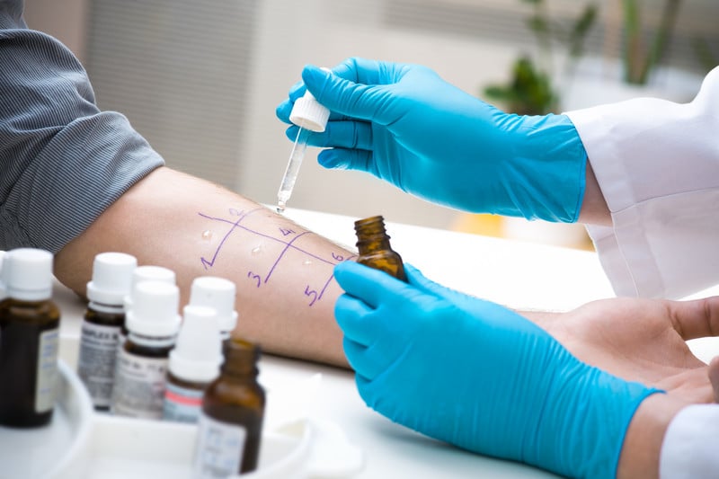 Guidelines for Reporting Allergy Testing and Immunotherapy Services