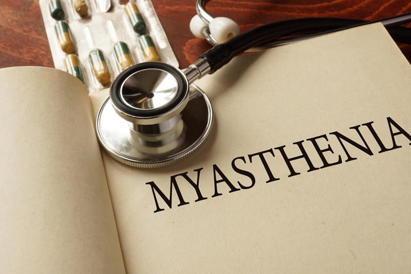 ICD-10 Codes to Report the Auto-Immune Disease Myasthenia Gravis