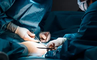 Medical Codes for Meniscectomy – A Common Arthroscopic Surgery