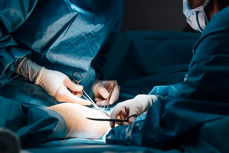 Medical Codes for Meniscectomy A Common Arthroscopic Surgery Medical Codes for Meniscectomy