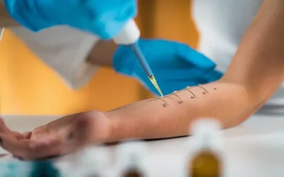 Guidelines for Reporting Allergy Testing and Immunotherapy Services